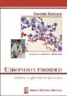 Carcinoma tiroideo. Teoria e gestione pratica