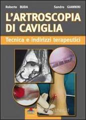L' artroscopia di caviglia. Tecnica e indirizzi terapeutici