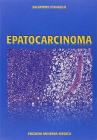 Epatocarcinoma